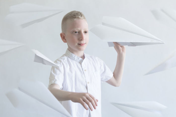 Фарфоровая красота: 13 фотографий «белоснежных» людей, которые кажутся очаровательными пришельцами Фарфоровая красота: 13 фотографий «белоснежных» людей, которые кажутся очаровательными пришельцами