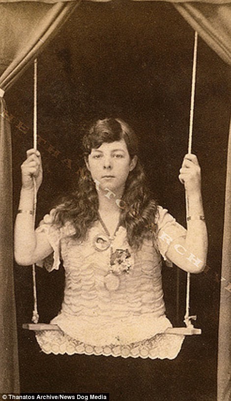 Девочка без ног, 1880-е годы деформация, люди