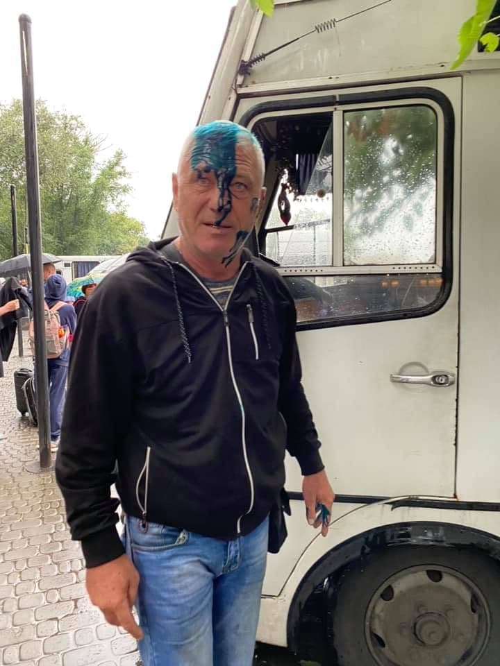 Украинские зондеркоманды продолжают калечить одесситов 