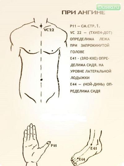ангина