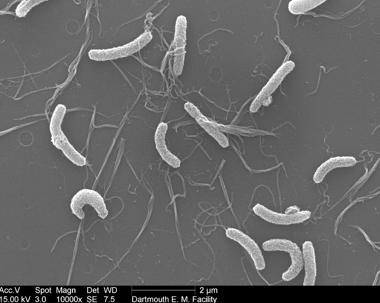 Холерный вибрион Vibrio cholerae под электронным микроскопом
