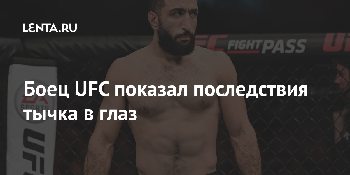 Боец UFC показал последствия тычка в глаз поединок, Мухаммад, Американский, несостоявшимся7, рамках, турнира, Абсолютного, бойцовского, чемпионата, Эдвардс, попал, пальцем, сопернику, после, остановили, признали, марта, ЭдвардсомСхватка, российский, проиграл