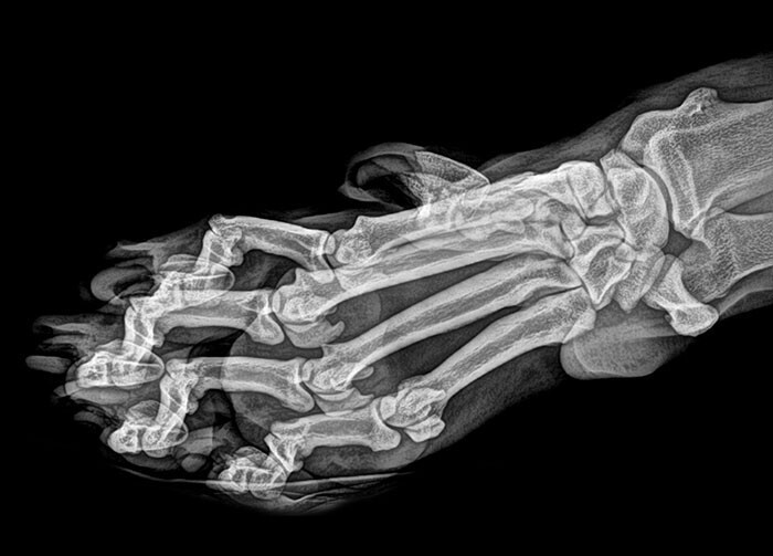 35 рентгеновских снимков, которые открывают мир с неожиданной стороны снимок, на рентгене, кошки, который, рентгеновский, сделал, беременной, на рентгенеРентгеновский, помогает, рентген, клетками, выглядит, позвоночникаКонкурс, металлической, очки»Рентген, со сколиозом, вставленный, и стволовыми, ее шарообразной«Вот, руки»Китаец