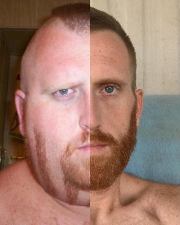 15. «Моё лицо до и после того, как я похудел» было стало, в мире, люди, подборка, сравнение, фото