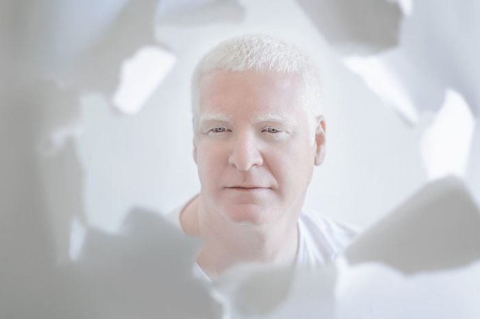 Фарфоровая красота: 13 фотографий «белоснежных» людей, которые кажутся очаровательными пришельцами Фарфоровая красота: 13 фотографий «белоснежных» людей, которые кажутся очаровательными пришельцами