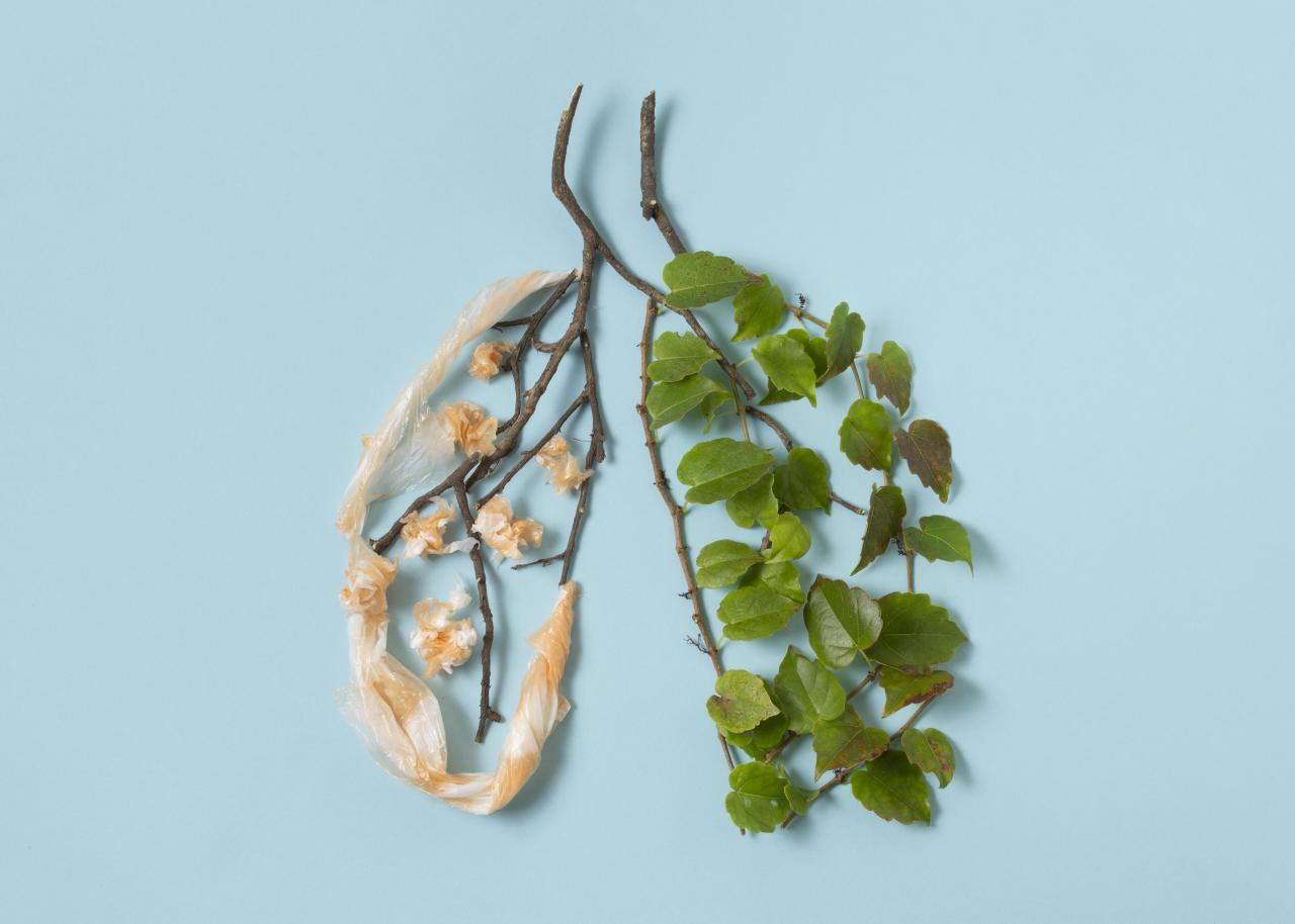 Почему после прививки заболевают туберкулезом — и еще 5 вопросов врачу о самой коварной болезни легких туберкулеза, детей, большинстве, случаев, туберкулезом, микобактерии, более, наличии, вакцина, успешно, жизни, может, легких, почему, человек, организме, человеком, вакцинации, вакциной, флюорография