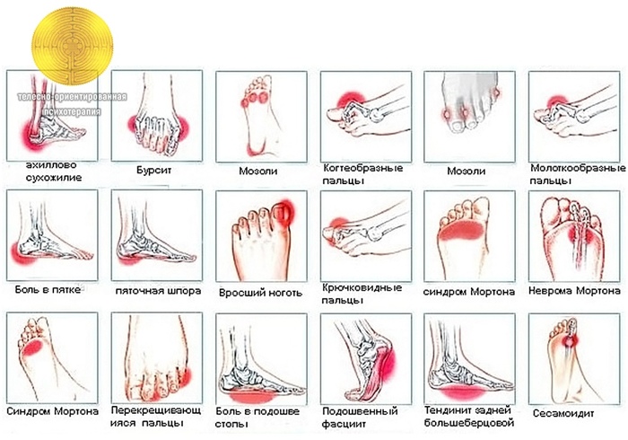 Ð‘ÐžÐ›Ð Ð’ Ð¡Ð¢ÐžÐŸÐ•. (700x490, 124Kb)