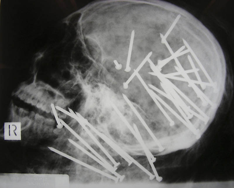 Cамые странные рентгеновские снимки