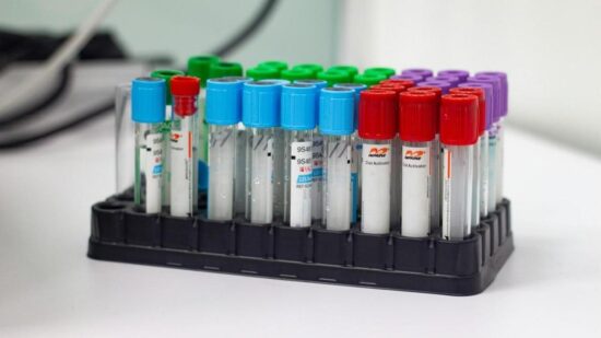 Зеленая, голубая, красная: почему крышки на пробирках для анализов бывают разных цветов