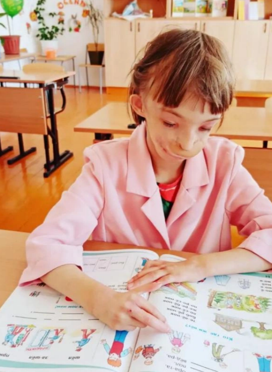 Как живет Дарина Шпенглер из шоу «Мужское / Женское» — девочка с половиной лица Шпенглер, врачи, Дарина, Елене, девочки, девочка, Елена, Девочка, патологии, счастью, ребенка, дочери, могли, будет, родилась, ребенок, Женское», «Мужское, девочке, сразу