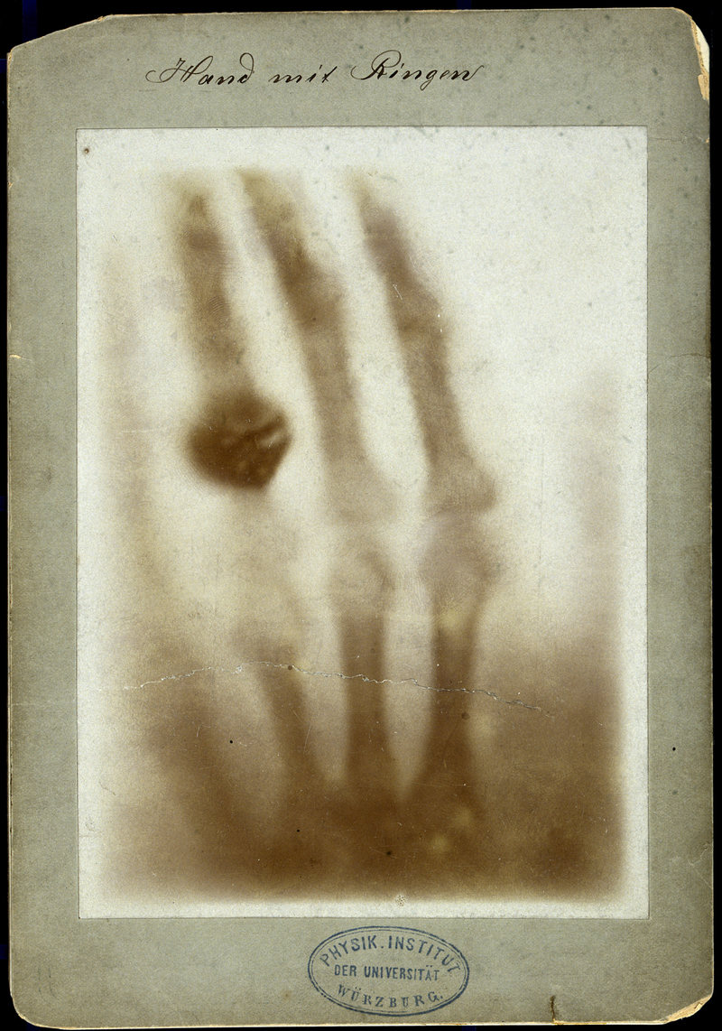 The first X-ray image, 