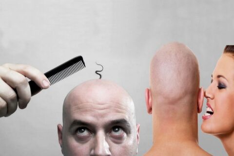 Невероятная история борьбы с облысением