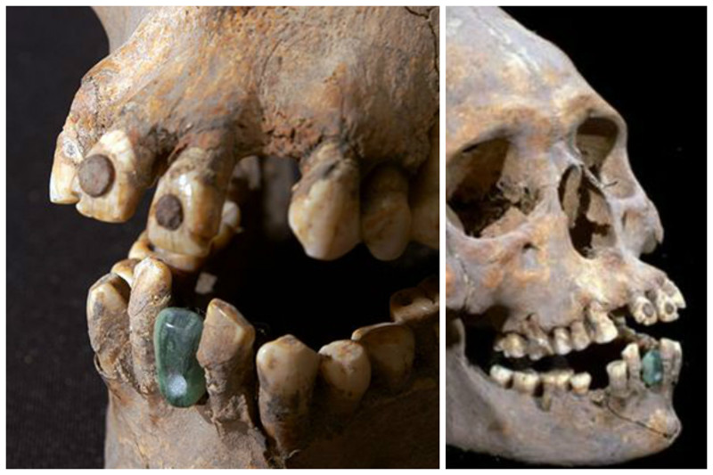 Захоронение женщины в Теотиуакане с зубом из жадеита, который был зацементирован или прикреплен волокном к ее нижней челюсти. интересное, прошлое, стоматологи, ужас, факты