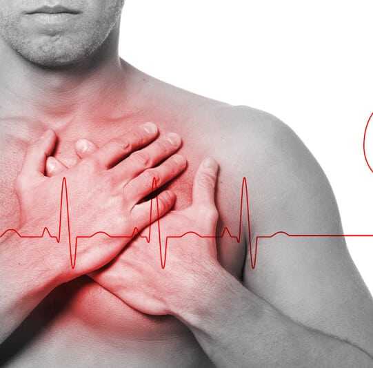 Как может маскироваться инфаркт миокарда: 6 нетипичных симптомов