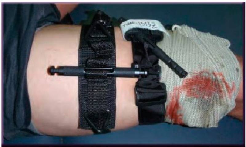 Конверсия турникета: когда и как нужно менять жгут на повязку оружие