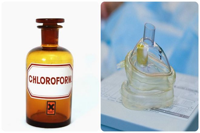 К 1800-м годам Джеймс Янг Симпсон был первым, кто экспериментировал с диэтиловым эфиром или хлороформом. Затем Симпсон попробовал хлороформ на роженицах и обнаружил, что достаточно просто вырубить женщину.