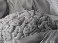 Дело о головном мозге Ленина: новые теории