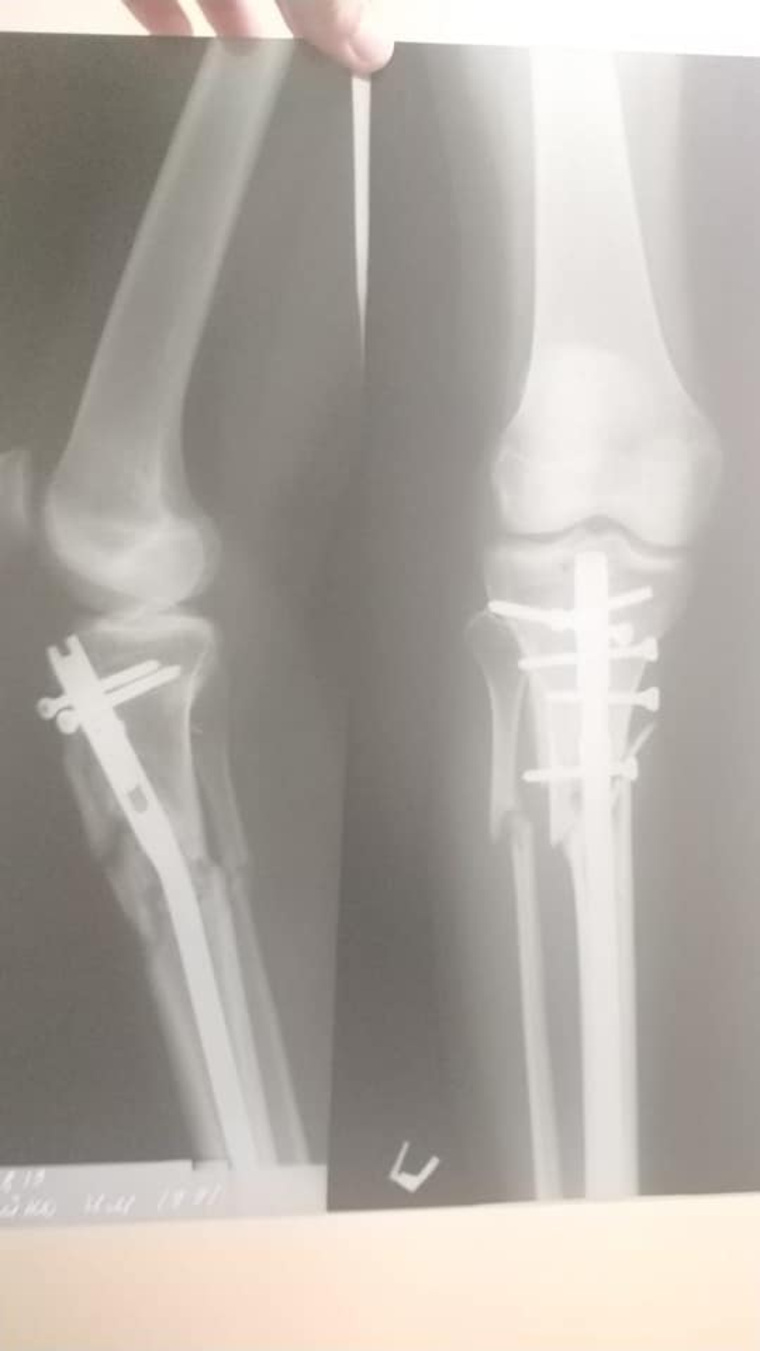 На Урале цыгане угрожают девушке, которую сбил их родственник На Урале цыгане угрожают девушке, которую сбил их родственник аварии,авто и мото,автоновости,Россия