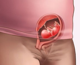 Первый триместр беременности. 