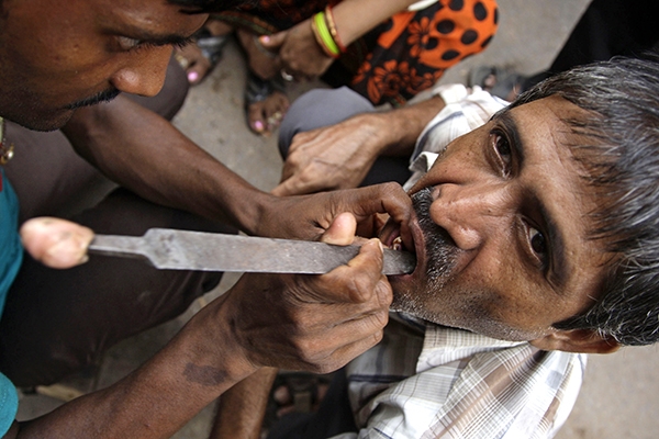 Уличные стоматологи в Индии: сервис для отважных и не брезгливых дантист,здоровье и медицина,зубы,лечение,стоматолог