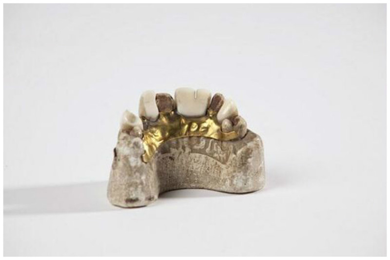 Частичный протез короля Эдуарда IV , 19 век интересное, прошлое, стоматологи, ужас, факты
