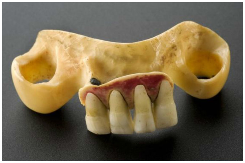 Такие зубы назывались "Зубы Ватерлоо" - поставки с полей сражений не прекращались. Эта челюсть сделала из кости бегемота плюс зубы Ватерлоо интересное, прошлое, стоматологи, ужас, факты