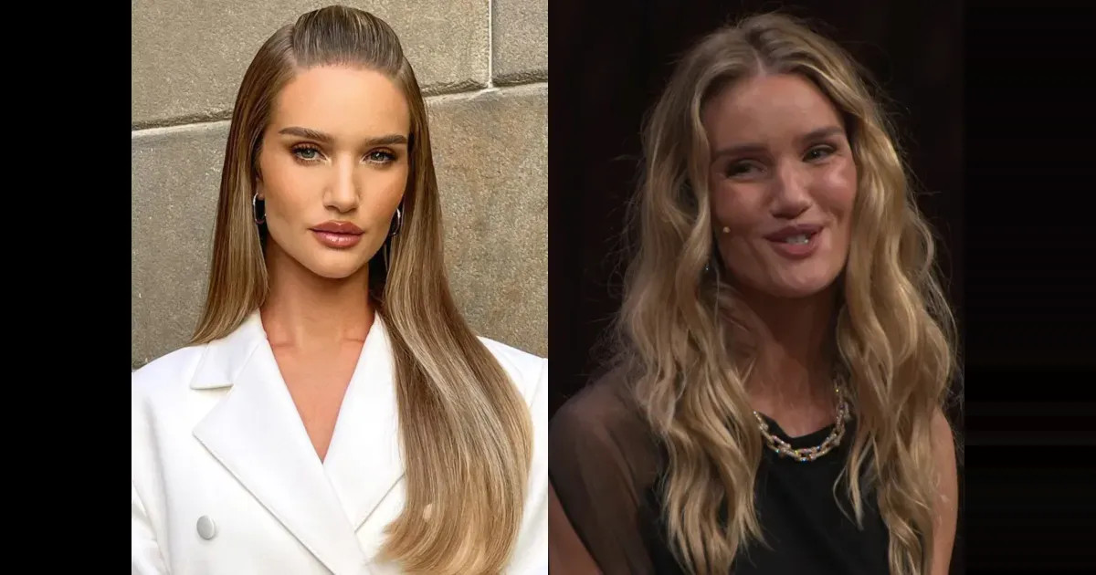 "Похожа на Стэтхема больше, чем он сам на себя". Рози Хантингтон-Уайтли заподозрили в злоупотреблении филлерами