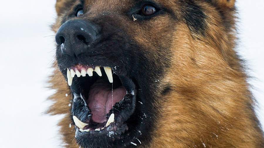В Краснодарском крае девочка-подросток лишилась половины лица от укуса собаки