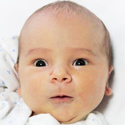 Лев Исаев, 1 месяц, врожденная двусторонняя косолапость, требуется лечение по методу Понсети, 158 620 ₽