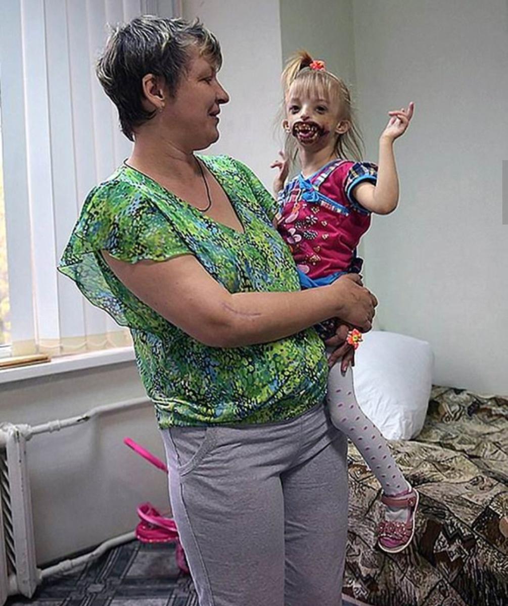 Как живет Дарина Шпенглер из шоу «Мужское / Женское» — девочка с половиной лица Шпенглер, врачи, Дарина, Елене, девочки, девочка, Елена, Девочка, патологии, счастью, ребенка, дочери, могли, будет, родилась, ребенок, Женское», «Мужское, девочке, сразу