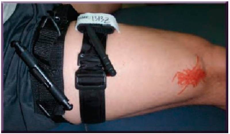 Конверсия турникета: когда и как нужно менять жгут на повязку оружие