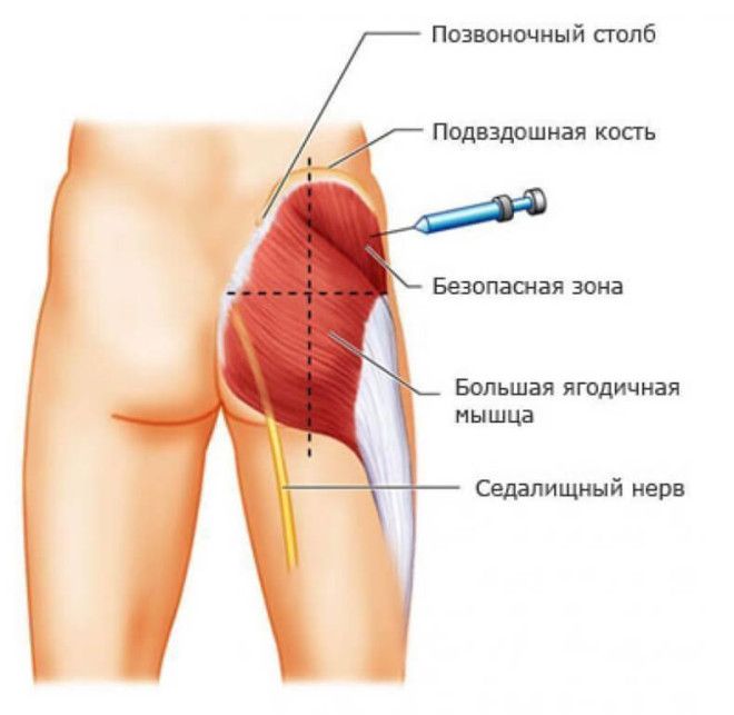 Как правильно делать инъекции?