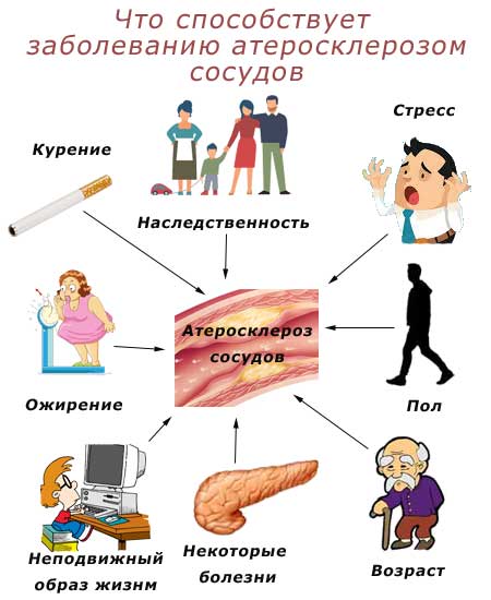 факторы, способствующие заболеванию атеросклерозом сосудов