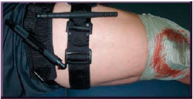 Конверсия турникета: когда и как нужно менять жгут на повязку оружие