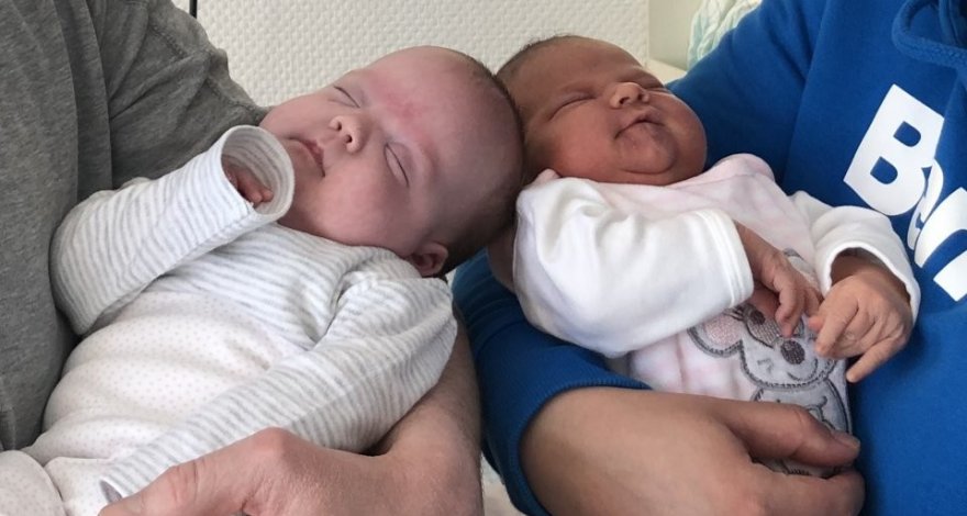 Эти близнецы родились с разницей в три месяца и стали настоящим прорывом в научном мире