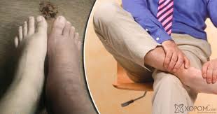 ÐšÐÑ€Ñ‚Ð¸Ð½ÐºÐ¸ Ð¿Ð¾ ÐÐÐ¿Ñ€Ð¾ÑÑƒ 6 Ð¿Ñ€ÐÐ´ÑƒÐ¿Ñ€ÐÐÐ´ÐÑŽÑ‰Ð¸Ñ… ÐÐ½ÐÐºÐ¾Ð² Ñ‚Ð¾Ð³Ð¾, Ñ‡Ñ‚Ð¾ Ð²ÐÑˆÐ ÑÐÑ€Ð´Ñ†Ð Ð½Ð Ñ€ÐÐÐ¾Ñ‚ÐÐÑ‚ Ð´Ð¾ÐÐÐ½Ñ‹Ð¼ Ð¾ÐÑ€ÐÐÐ¾Ð¼