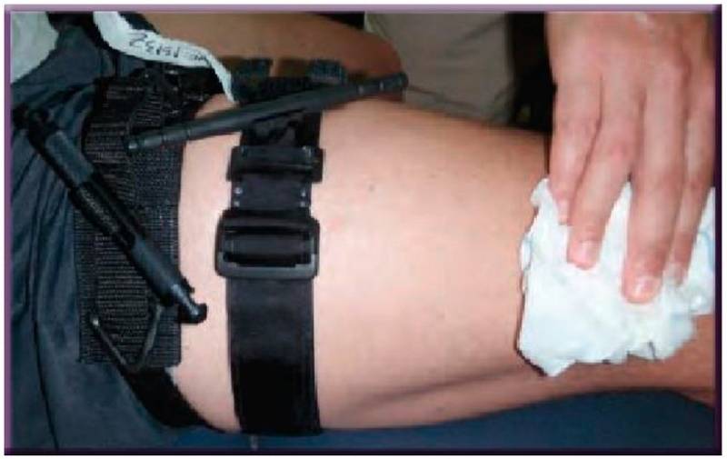 Конверсия турникета: когда и как нужно менять жгут на повязку оружие