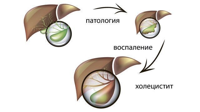 Степени тяжести