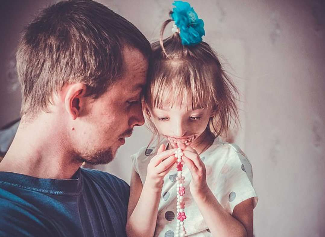 Как живет Дарина Шпенглер из шоу «Мужское / Женское» — девочка с половиной лица Шпенглер, врачи, Дарина, Елене, девочки, девочка, Елена, Девочка, патологии, счастью, ребенка, дочери, могли, будет, родилась, ребенок, Женское», «Мужское, девочке, сразу