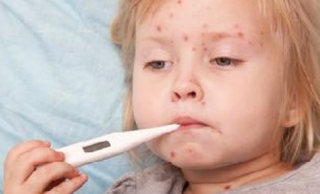 На Львовщине ширится эпидемия кори, а половина детей не имеет прививок