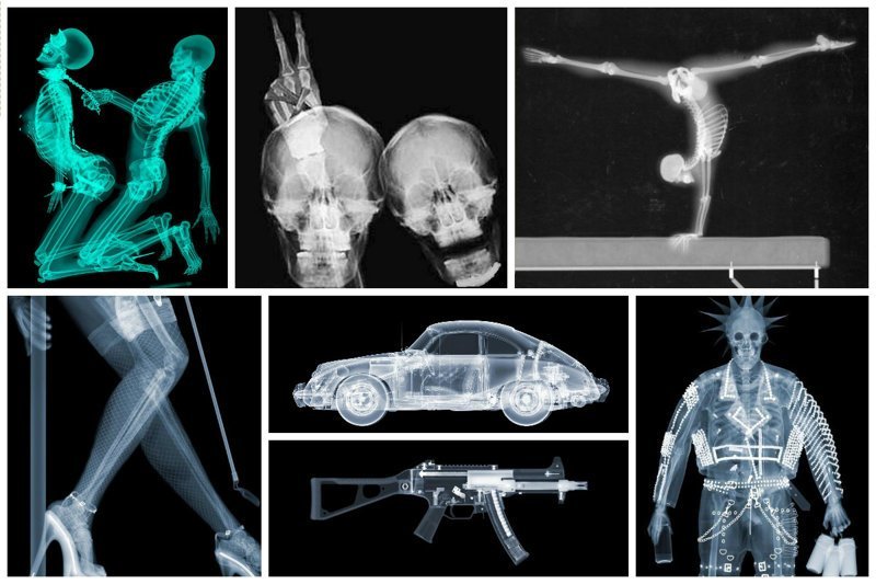 Мир в рентгеновских лучах - вид искусства, где видна изнанка бытия внутри, интересное, искусство, рентген, скелет, снимки
