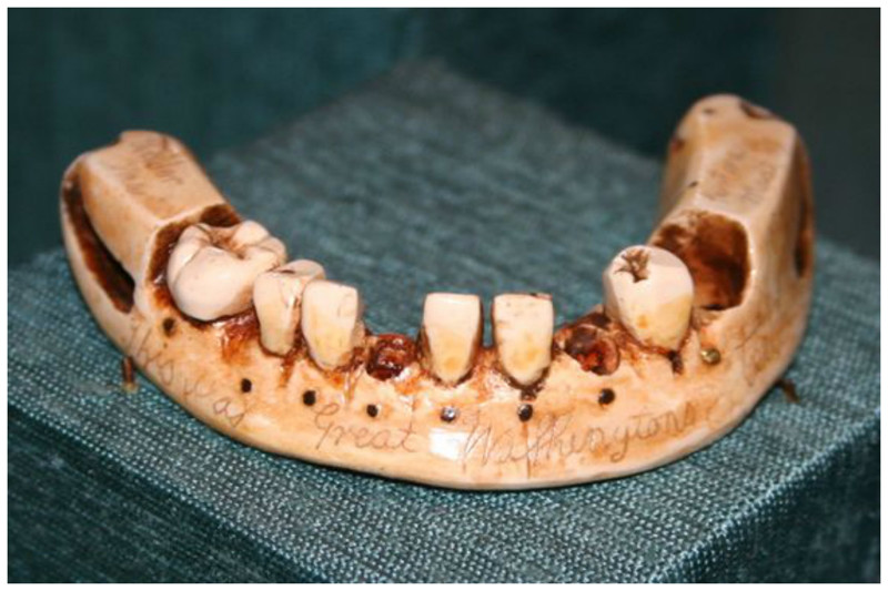 Зубы вырывались у погибших в бою солдат и продавались для протезирования интересное, прошлое, стоматологи, ужас, факты