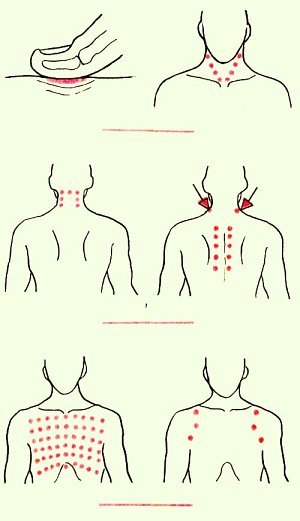 Шиацу при простудных заболеваниях: просто нажмите на эти точки!