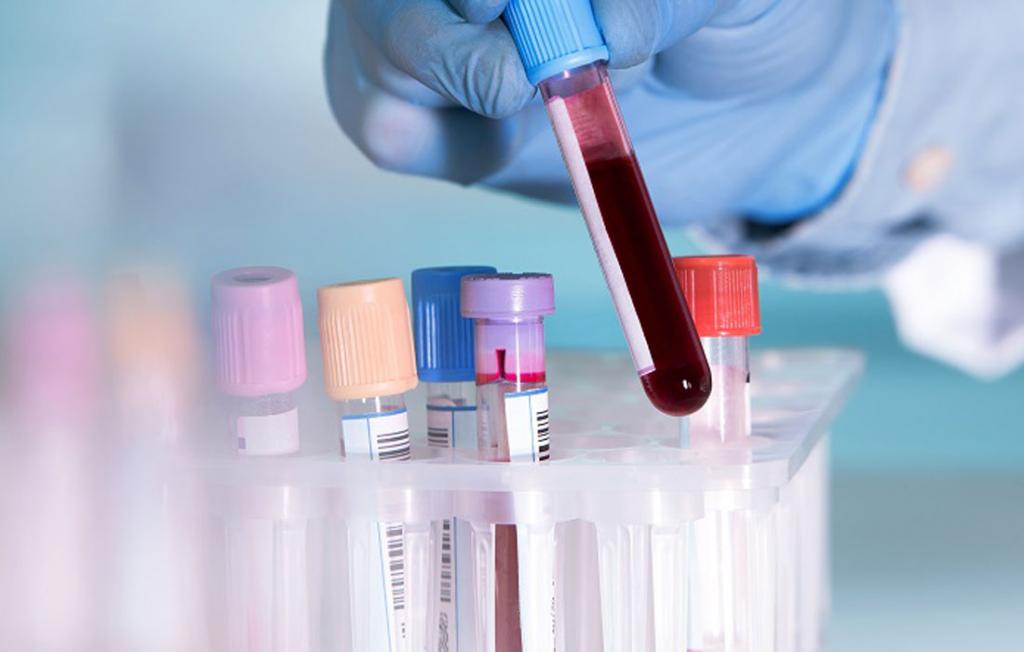 Какой анализ покажет онкологию? Признаки онкологии по анализу крови