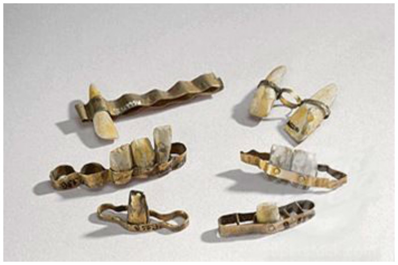 Этруски делали зубные протезы в 7 веке до н.э. интересное, прошлое, стоматологи, ужас, факты