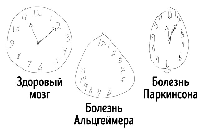 Картинки для проверки альцгеймера тесты