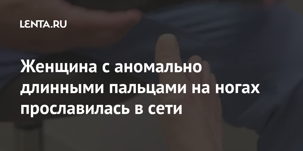 Женщина с аномально длинными пальцами на ногах прославилась в сети Женщина с аномально длинными пальцами на ногах прославилась в сети Ценности