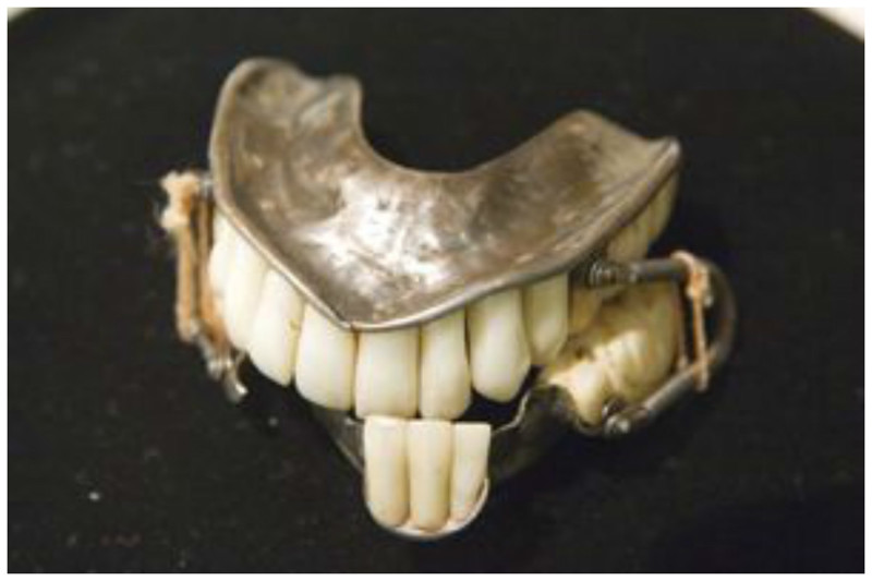 Серебряные протезы, прикрепленные букальными проволочными пружинами, около 1829 года. В этом полном верхнем и частично нижнем протезе передние зубы изготовлены из фарфора, а задние моляры вырезаны из слоновой кости. интересное, прошлое, стоматологи, ужас, факты