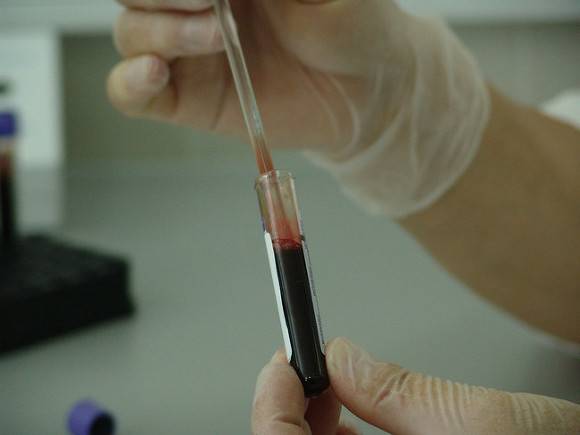 Японские ученые назвали самую «опасную» группу крови Группа крови,интересное,наука,ученые