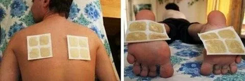 Горчичник: по документам - француз, но в душе русский Медицина и здоровье